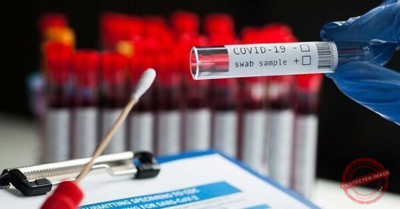 Read more about the article مجموعة اختبار جديدة للكشف عن كورونا