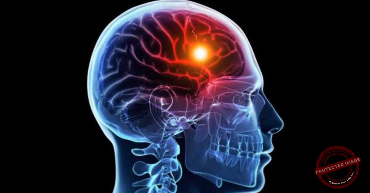 Read more about the article ما هي أعراض الجلطة