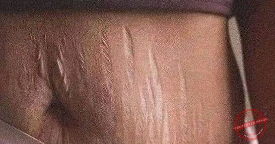 Read more about the article تذكر كم كان جسدها جميلاً ناعماً