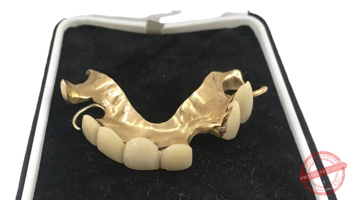 Read more about the article أسنان تشرشل في مزاد علني